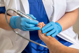 Frezen schimmelnagel